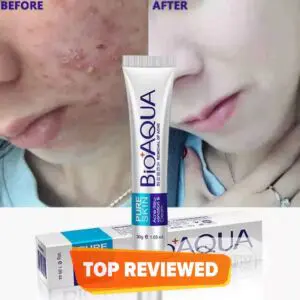 BioAqua Acne Scar Mark Removal Treatment Cream 30ml