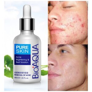 BioAqua Pure Skin Acne Serum Facial Removal Solution
