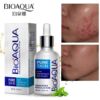 BIOAQUA Pure Skin Acne Removal & Brightening Serum (30ml)
